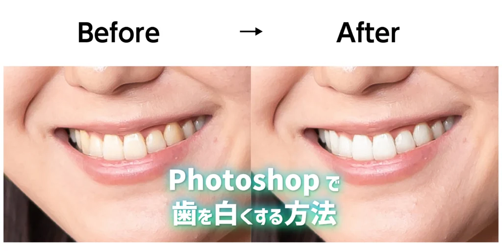 Photoshopで歯を白くする方法のアイキャッチ