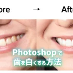 Photoshopで歯を白くする方法のアイキャッチ